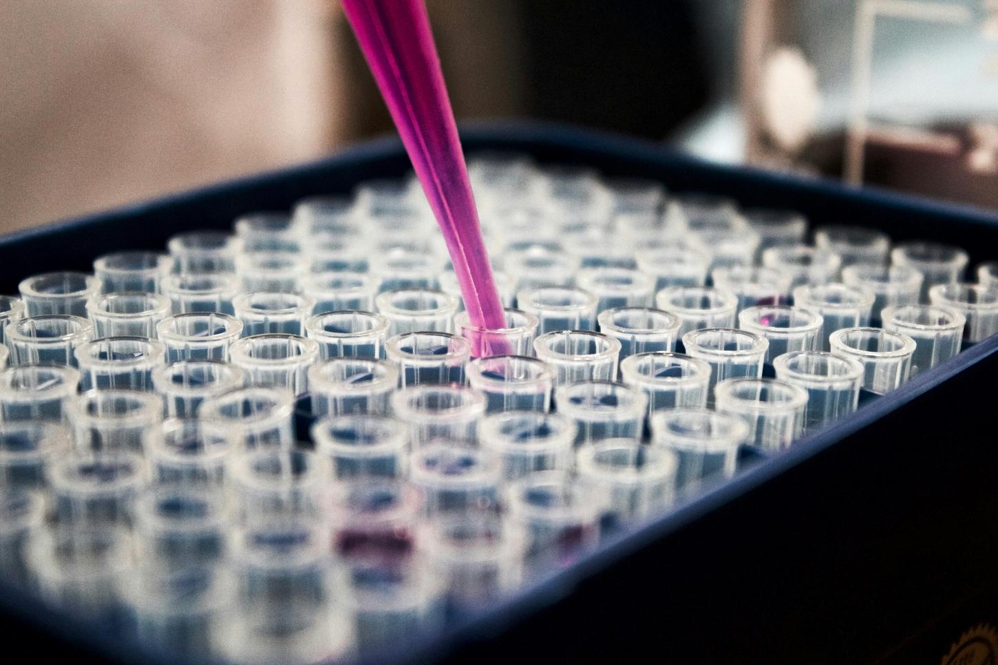 Pipette: The Essential Laboratory Tool for Precision Liquid Handling